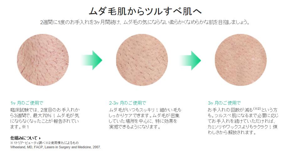 tria トリア・パーソナルレーザー脱毛器