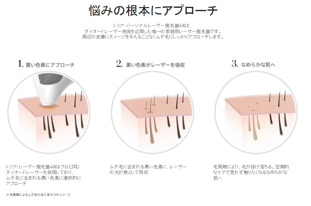 トリア(tria) 家庭用パーソナルレーザー脱毛器4X フーシャピンク